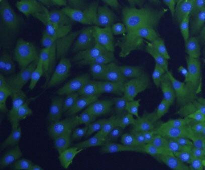 Alpha-Smooth Muscle Actin Antibody in Immunocytochemistry (ICC/IF)