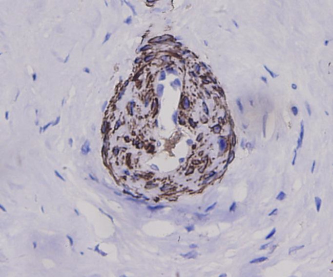 Alpha-Smooth Muscle Actin Antibody in Immunohistochemistry (Paraffin) (IHC (P))