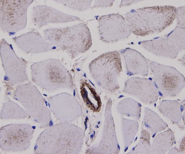 Alpha-Smooth Muscle Actin Antibody in Immunohistochemistry (Paraffin) (IHC (P))