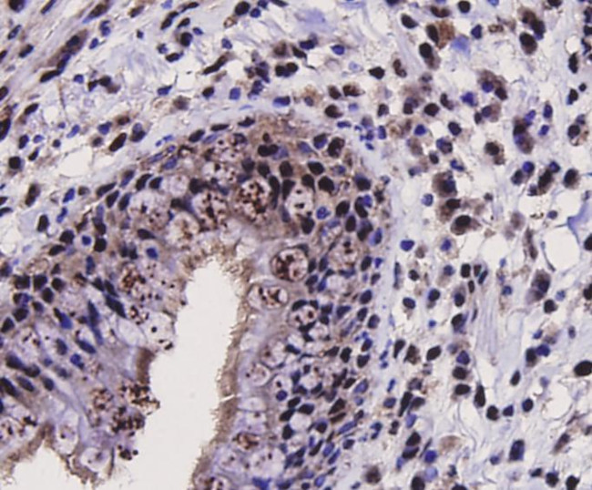 SIRT1 Antibody in Immunohistochemistry (Paraffin) (IHC (P))