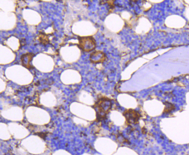 CD61 (Integrin beta 3) Antibody in Immunohistochemistry (Paraffin) (IHC (P))