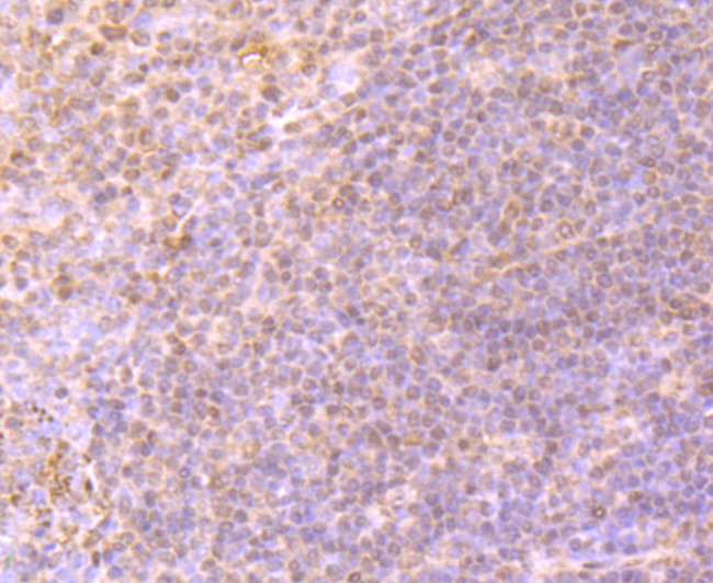 CD61 (Integrin beta 3) Antibody in Immunohistochemistry (Paraffin) (IHC (P))