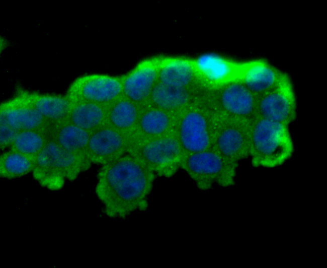 PR3 Antibody in Immunocytochemistry (ICC/IF)