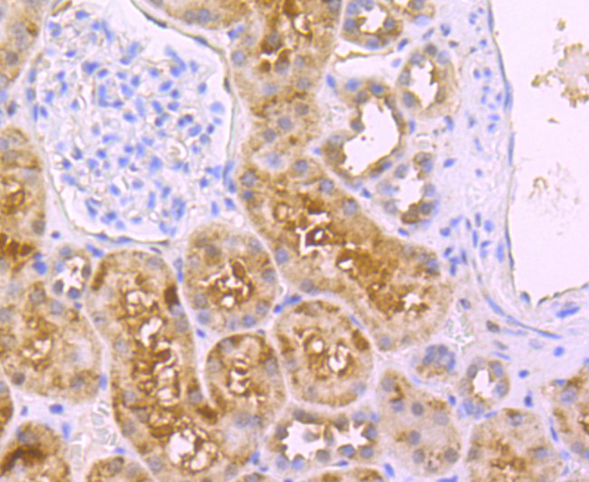 DLL4 (delta-like 4) Antibody in Immunohistochemistry (Paraffin) (IHC (P))