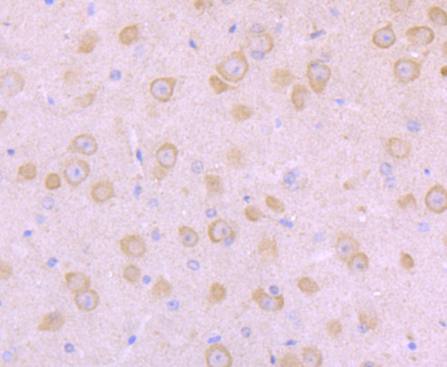 SCN10A Antibody in Immunohistochemistry (Paraffin) (IHC (P))