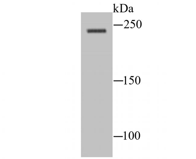 SCN10A Antibody in Western Blot (WB)
