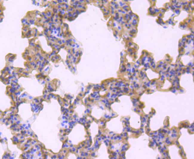 TNFAIP3 Antibody in Immunohistochemistry (Paraffin) (IHC (P))