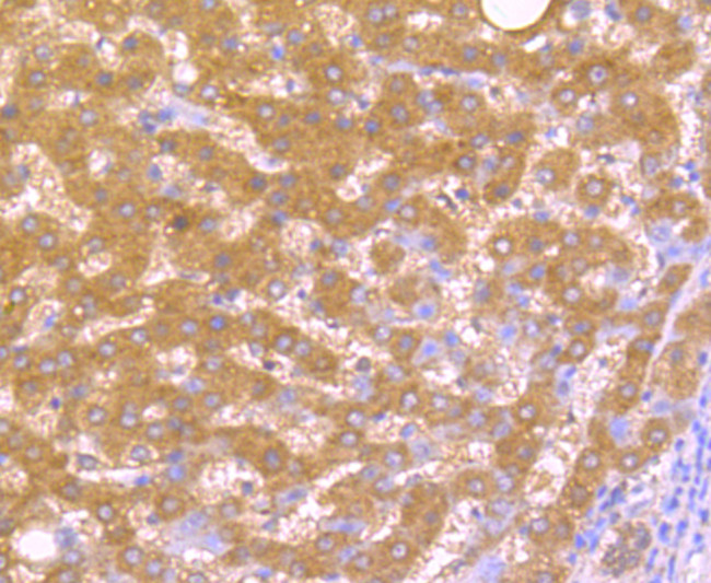 TNFAIP3 Antibody in Immunohistochemistry (Paraffin) (IHC (P))