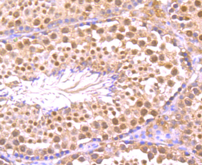 TNFAIP3 Antibody in Immunohistochemistry (Paraffin) (IHC (P))