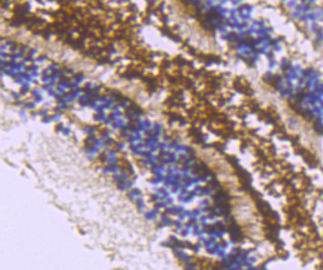 ZIP12 Antibody in Immunohistochemistry (Paraffin) (IHC (P))