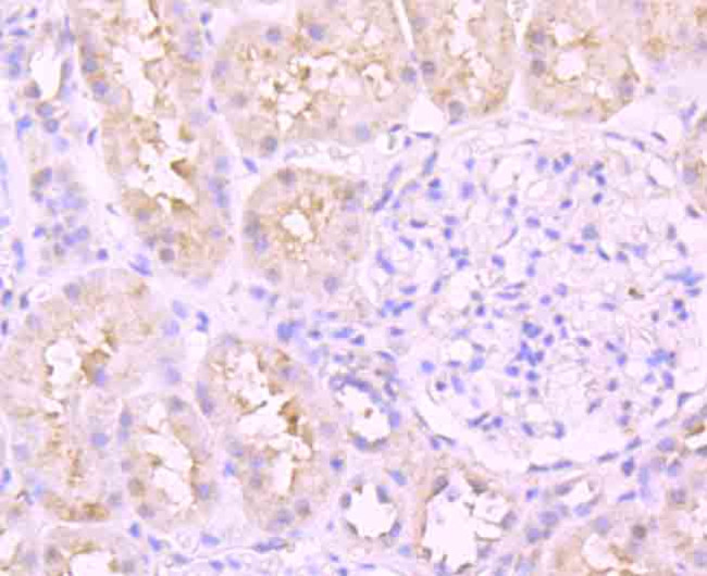 ATF6 Antibody in Immunohistochemistry (Paraffin) (IHC (P))