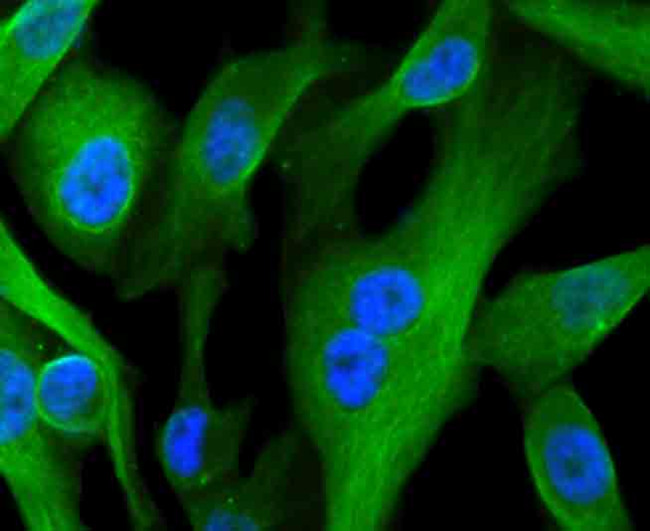 CD71 (Transferrin Receptor) Antibody in Immunocytochemistry (ICC/IF)