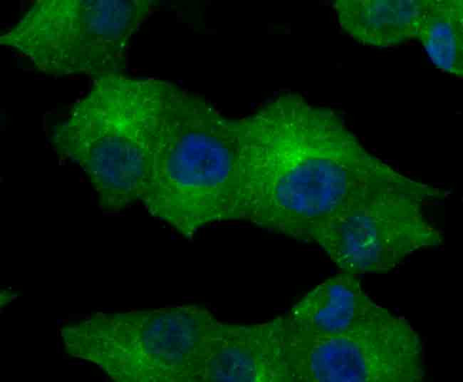 CD71 (Transferrin Receptor) Antibody in Immunocytochemistry (ICC/IF)