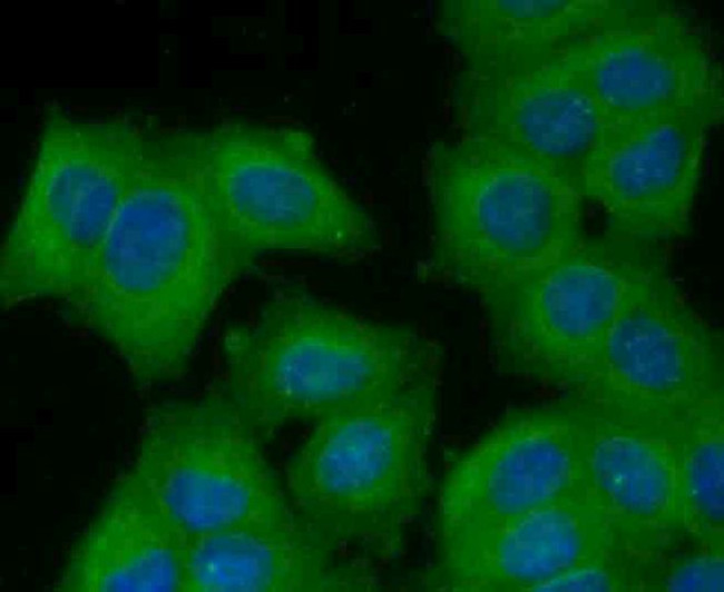 CD71 (Transferrin Receptor) Antibody in Immunocytochemistry (ICC/IF)