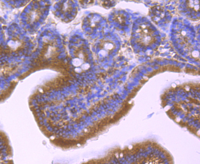 PPM1A Antibody in Immunohistochemistry (Paraffin) (IHC (P))