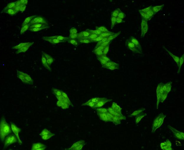 VCP Antibody in Immunocytochemistry (ICC/IF)