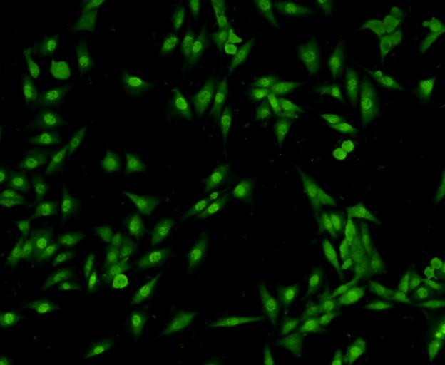 VCP Antibody in Immunocytochemistry (ICC/IF)