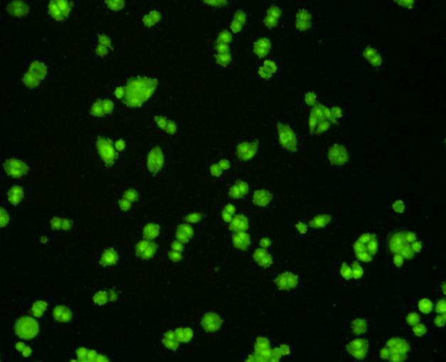 VCP Antibody in Immunocytochemistry (ICC/IF)