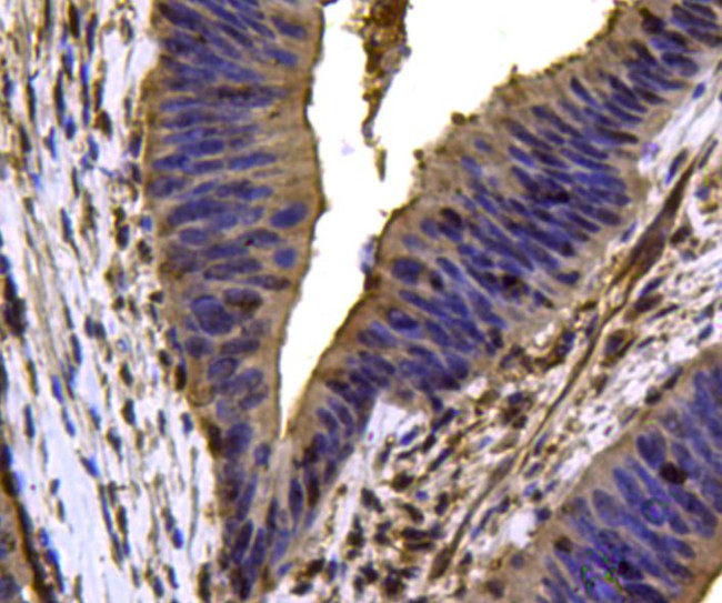 VCP Antibody in Immunohistochemistry (Paraffin) (IHC (P))