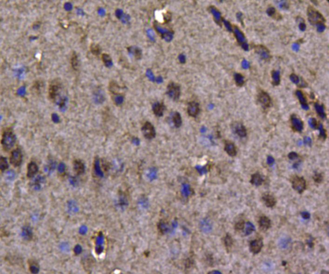 VCP Antibody in Immunohistochemistry (Paraffin) (IHC (P))