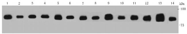 VCP Antibody in Western Blot (WB)