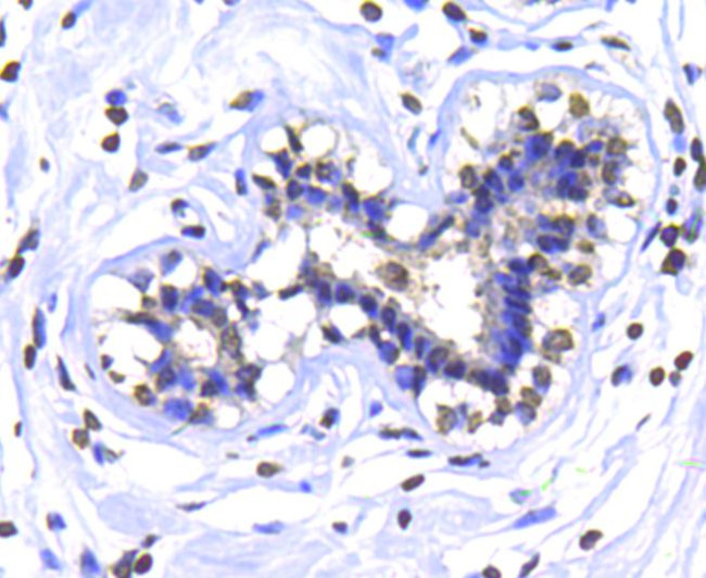 IKK alpha Antibody in Immunohistochemistry (Paraffin) (IHC (P))