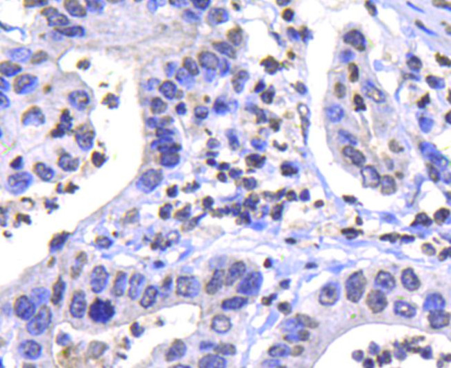 IKK alpha Antibody in Immunohistochemistry (Paraffin) (IHC (P))