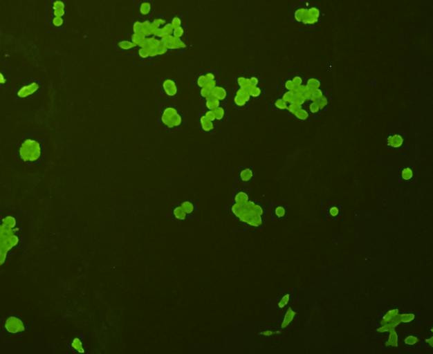 p70 S6 Kinase Antibody in Immunocytochemistry (ICC/IF)