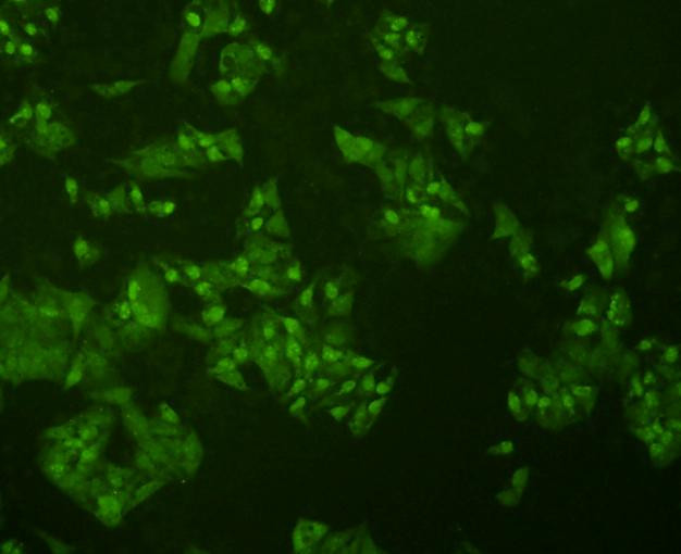 p70 S6 Kinase Antibody in Immunocytochemistry (ICC/IF)