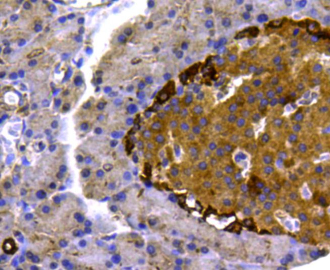 p70 S6 Kinase Antibody in Immunohistochemistry (Paraffin) (IHC (P))