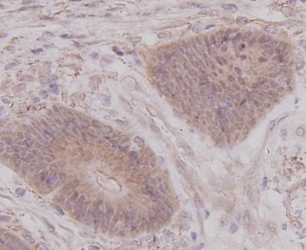 p70 S6 Kinase Antibody in Immunohistochemistry (Paraffin) (IHC (P))