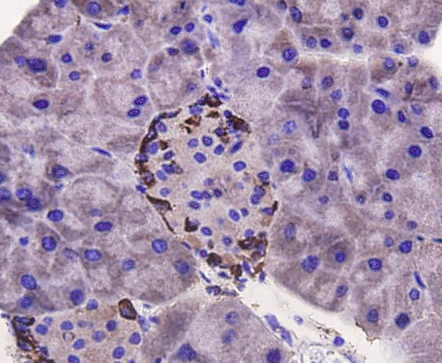 p70 S6 Kinase Antibody in Immunohistochemistry (Paraffin) (IHC (P))