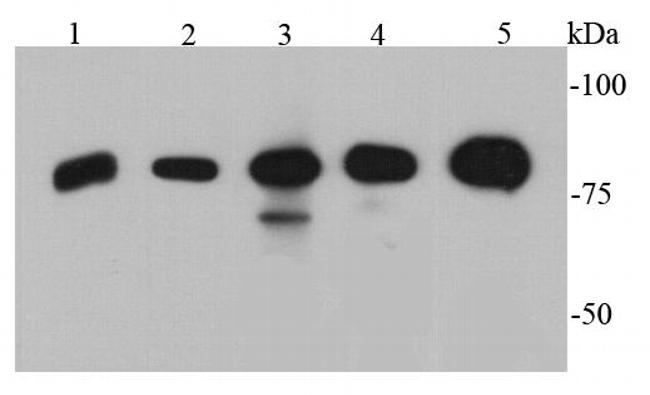 p70 S6 Kinase Antibody in Western Blot (WB)