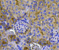 Pan Ras Antibody in Immunohistochemistry (Paraffin) (IHC (P))