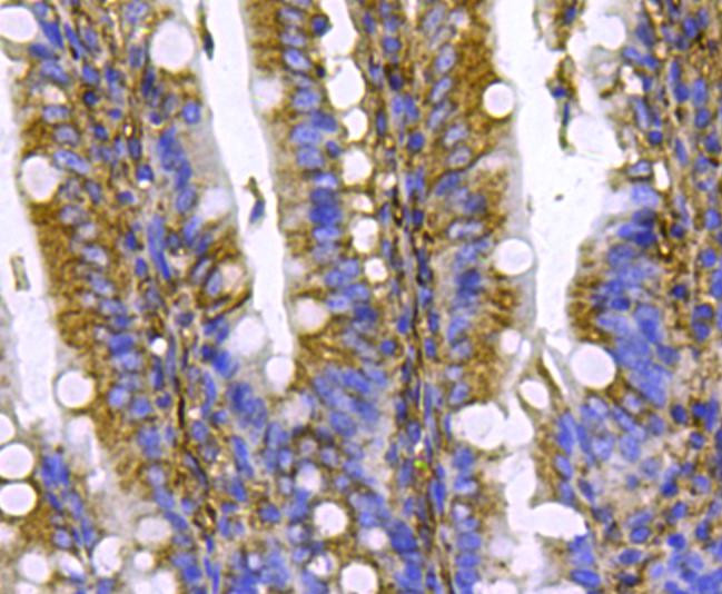 Pan Ras Antibody in Immunohistochemistry (Paraffin) (IHC (P))