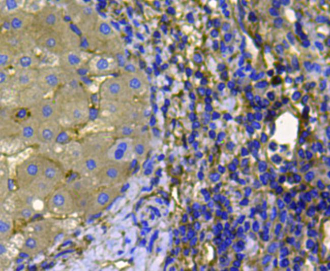 Pan Ras Antibody in Immunohistochemistry (Paraffin) (IHC (P))