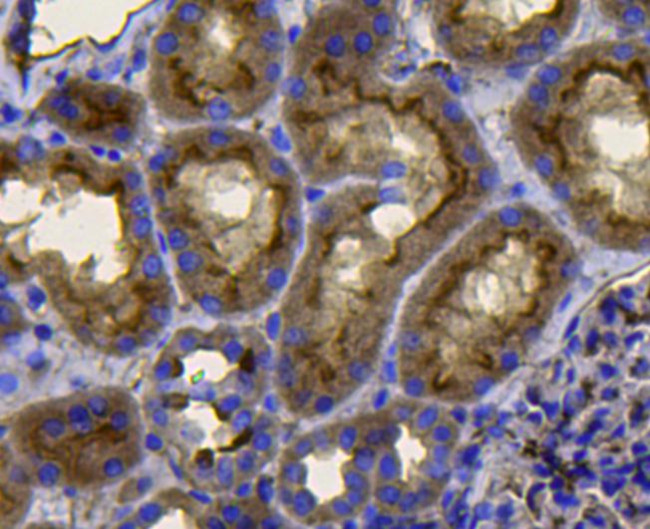 Pan Ras Antibody in Immunohistochemistry (Paraffin) (IHC (P))