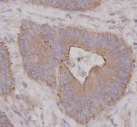 ROCK1 Antibody in Immunohistochemistry (Paraffin) (IHC (P))