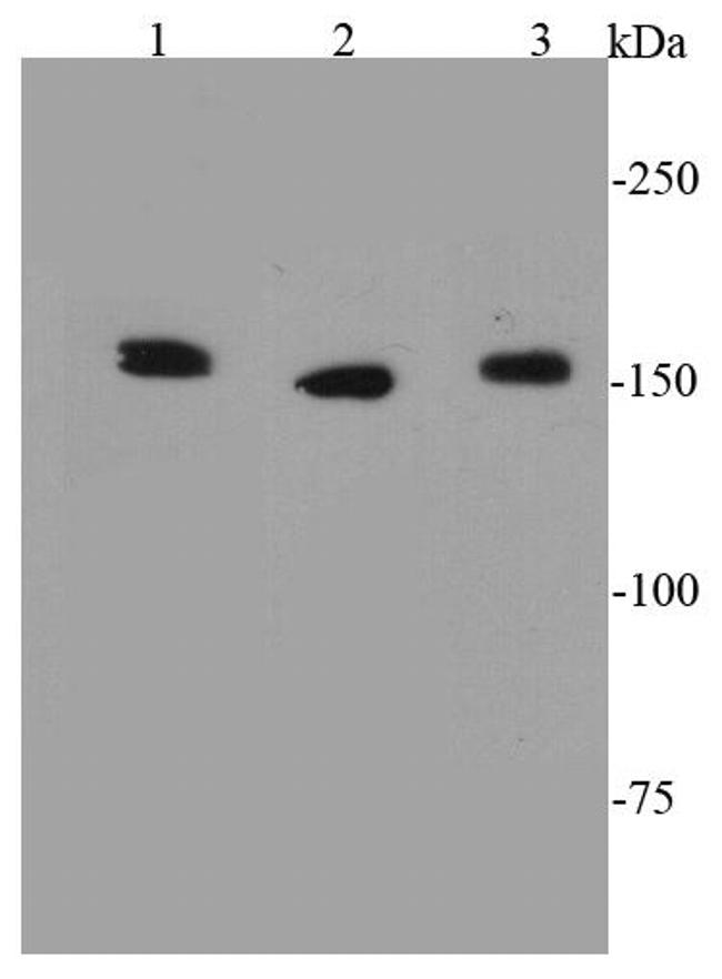 ROCK1 Antibody in Western Blot (WB)