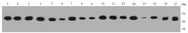 PDI Antibody in Western Blot (WB)