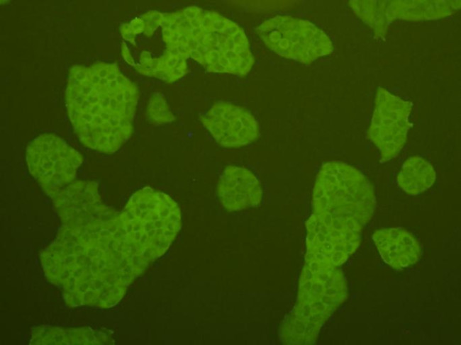 c-Met Antibody in Immunocytochemistry (ICC/IF)