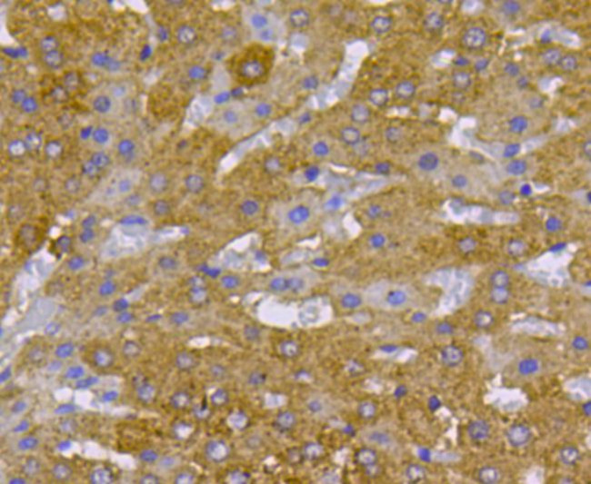 c-Met Antibody in Immunohistochemistry (Paraffin) (IHC (P))