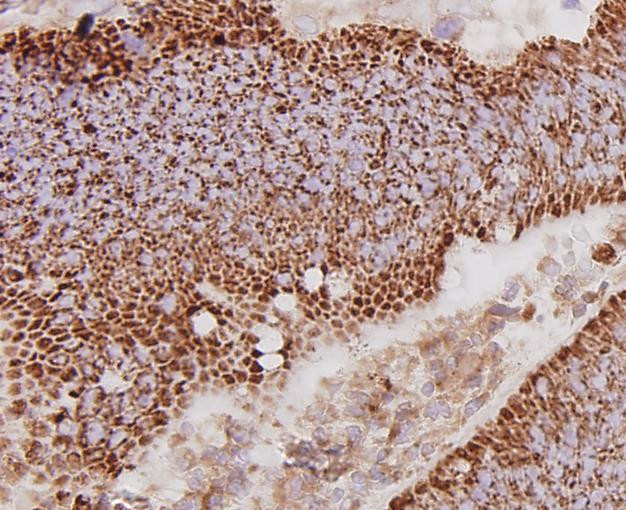 c-Met Antibody in Immunohistochemistry (Paraffin) (IHC (P))