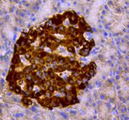 Chromogranin A Antibody in Immunohistochemistry (Paraffin) (IHC (P))