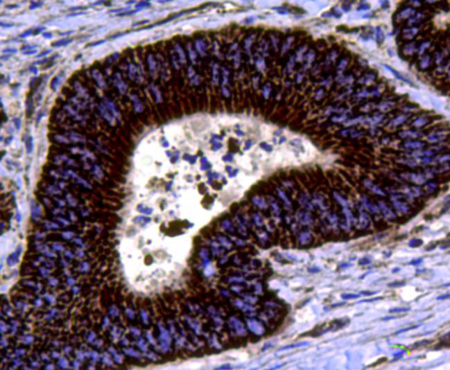 Chromogranin A Antibody in Immunohistochemistry (Paraffin) (IHC (P))