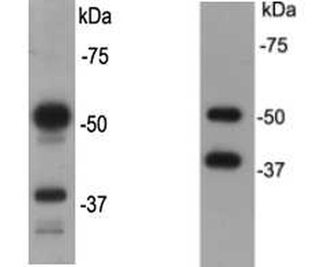 CD79a Antibody in Western Blot (WB)