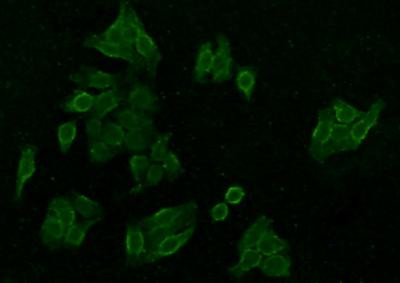 CaMKII delta Antibody in Immunocytochemistry (ICC/IF)