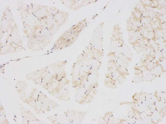 CaMKII delta Antibody in Immunohistochemistry (Paraffin) (IHC (P))