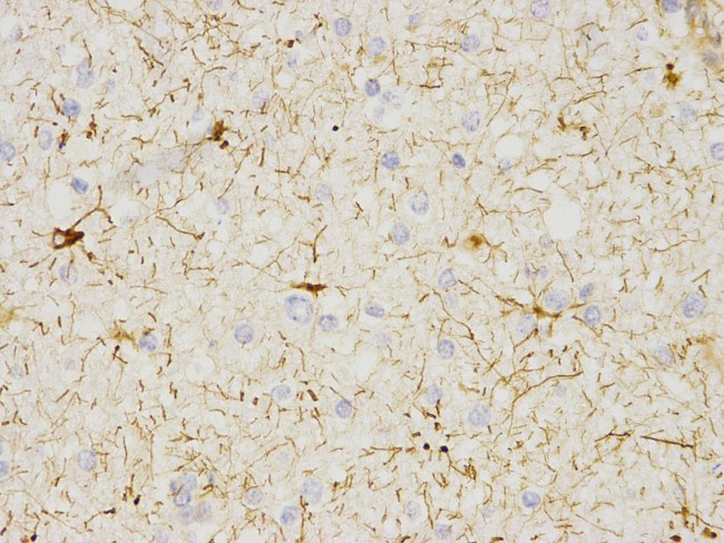 CaMKII delta Antibody in Immunohistochemistry (Paraffin) (IHC (P))