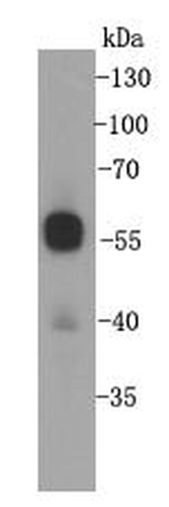 Cyclin B1 Antibody in Western Blot (WB)